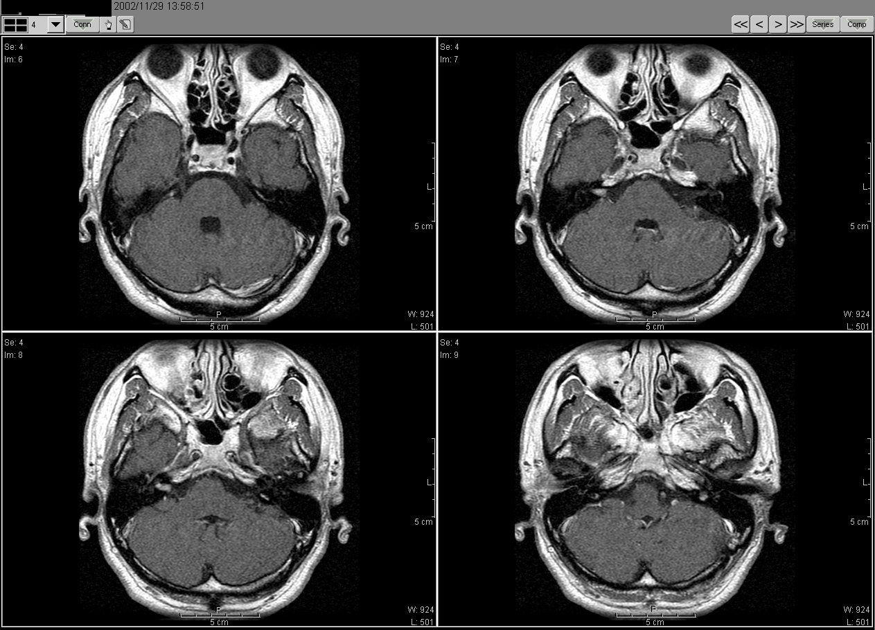 2002_11_11MRI02