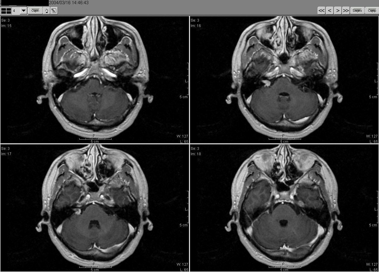 2004_03_16MRI02