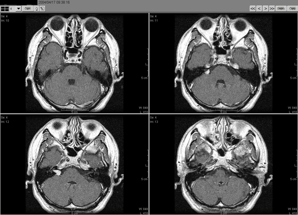 2004_04_17MRI02