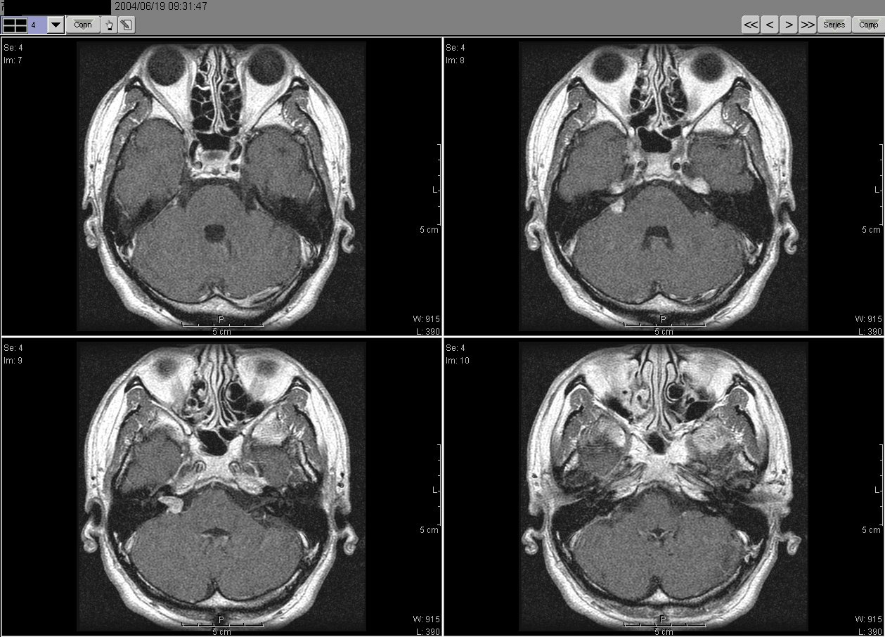 2004_06_19MRI02