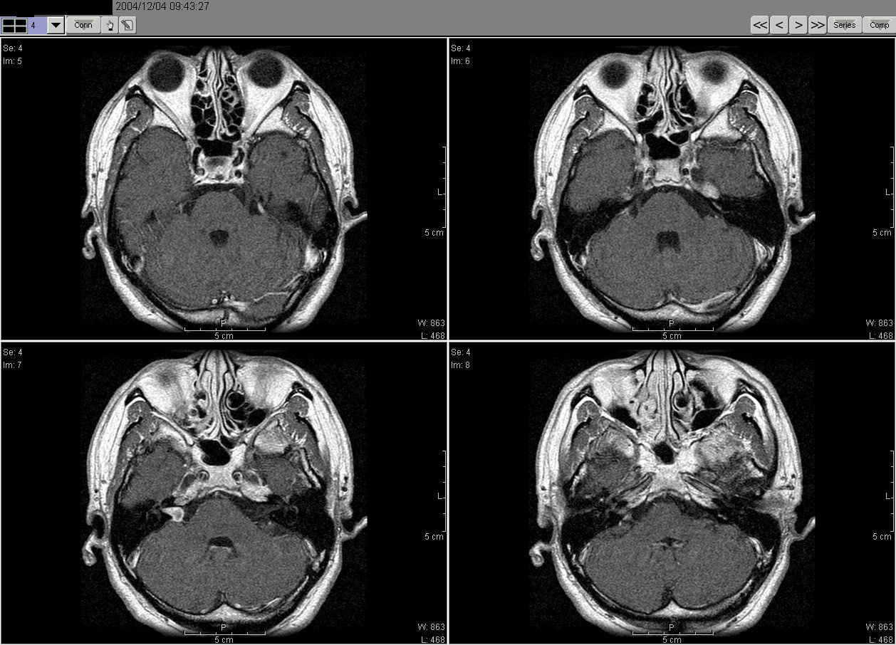 2004_12_04MRI02