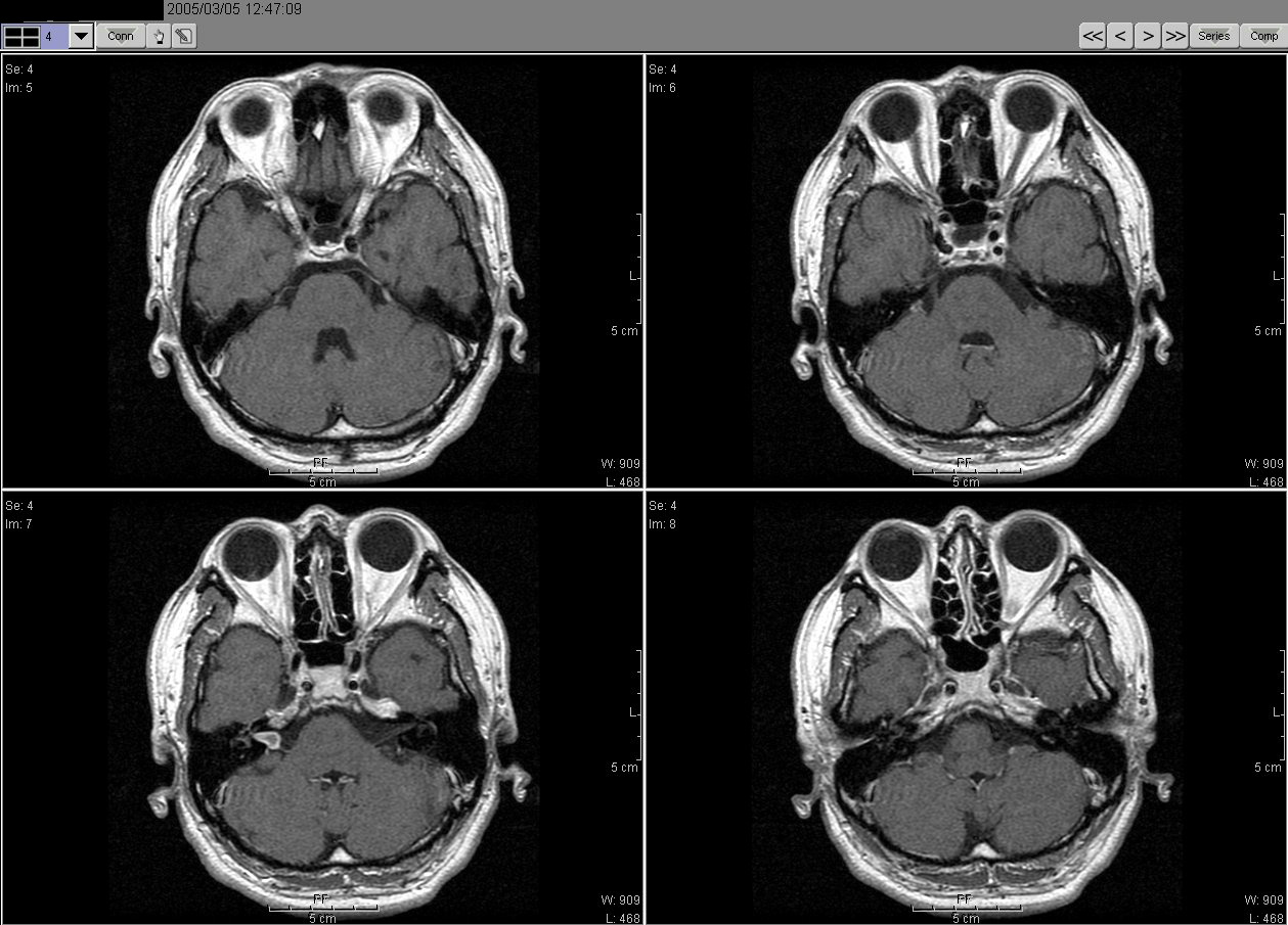 2005_03_05MRI02