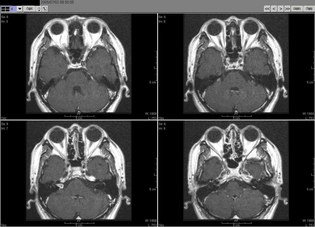 2005_07_02MRI02