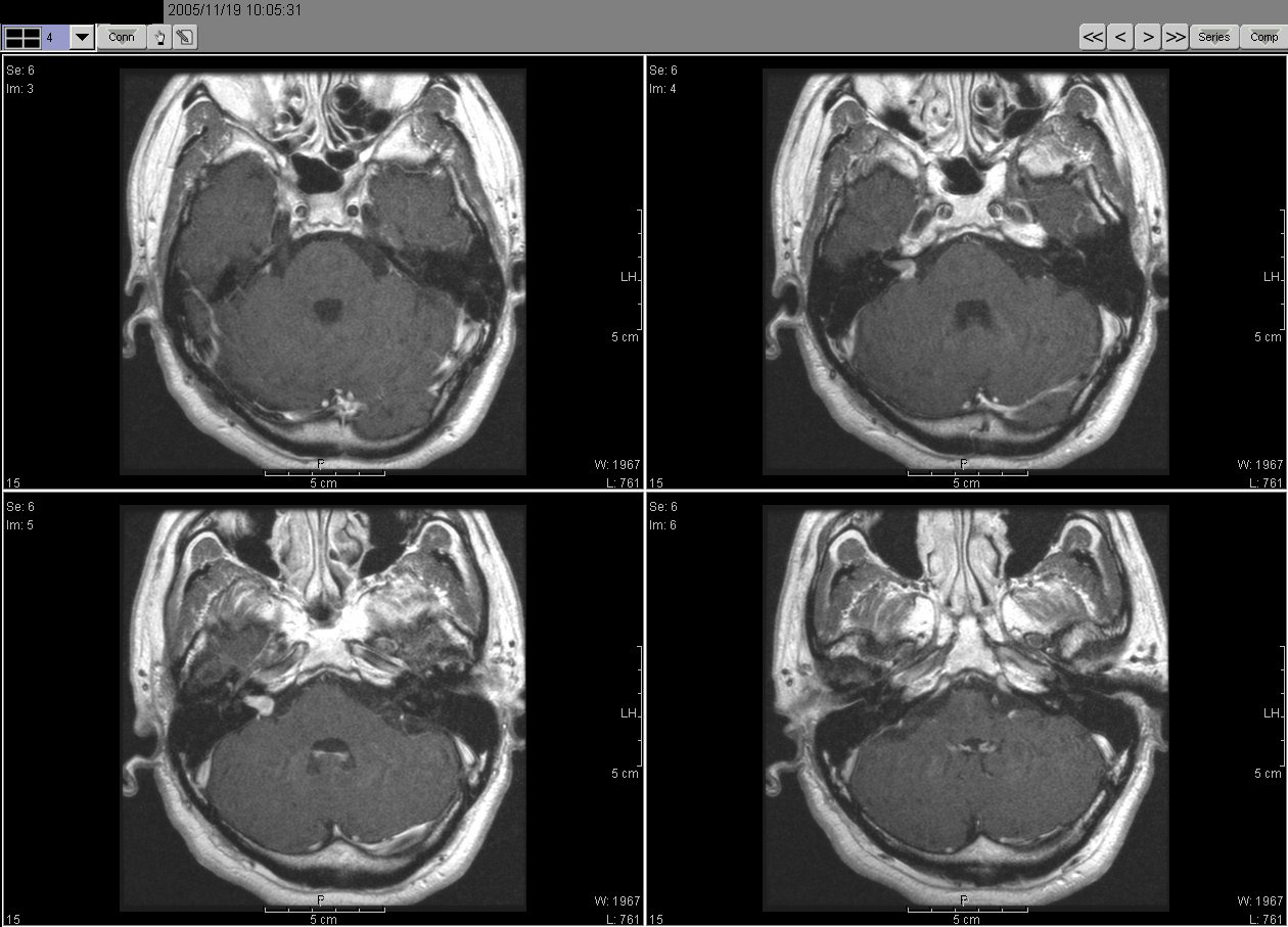 2005_11_19MRI02