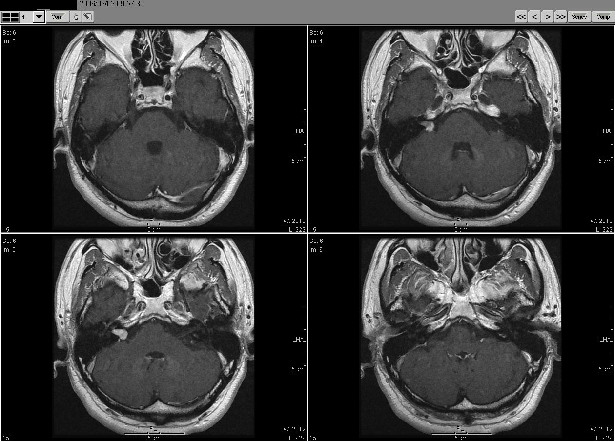 2006_02_02MRI02