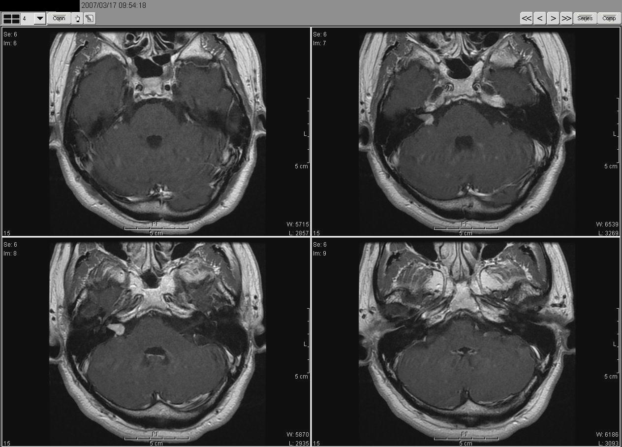 2007_03_17MRI02