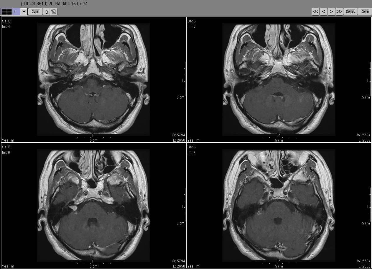 2008_03_04MRI02