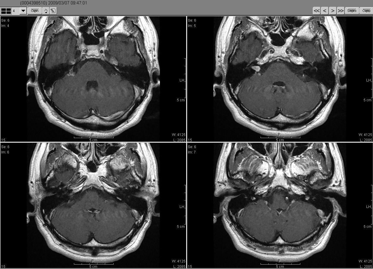 2009_03_07MRI02