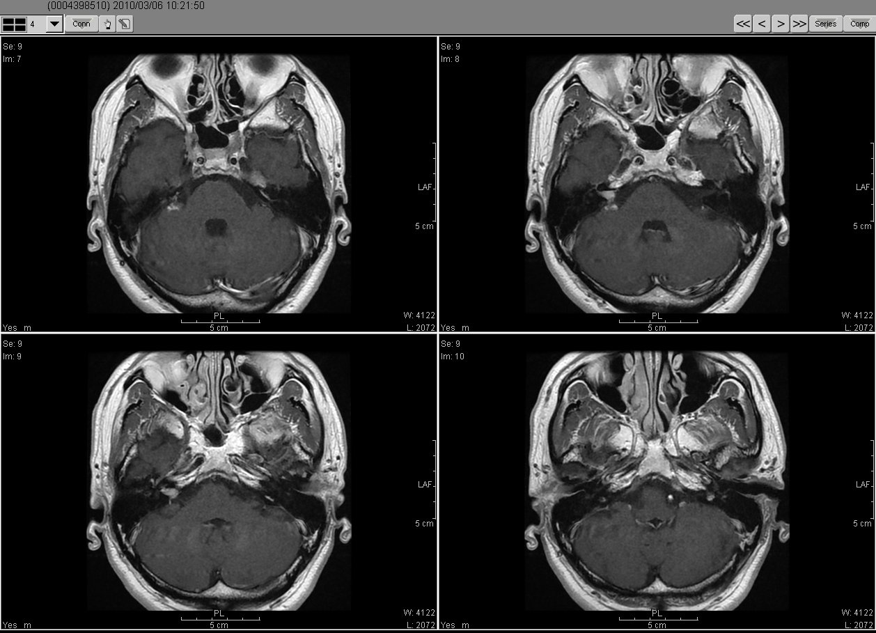 2019_03_06MRI02